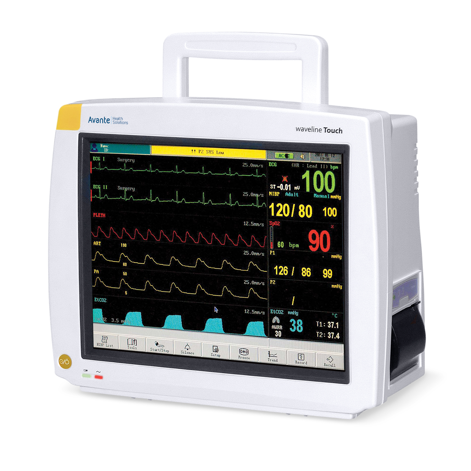 Cardiac Monitors